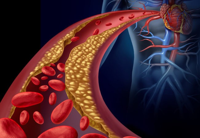 Type of high Blood pressure